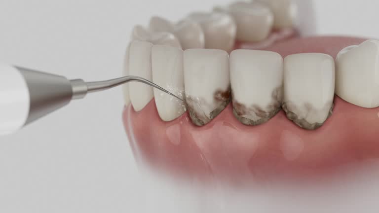 Reliable Emergency Dentist contractor in Contra Costa Centre, CA by Smile Center Dentistry